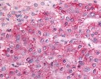 GPRC5C Antibody