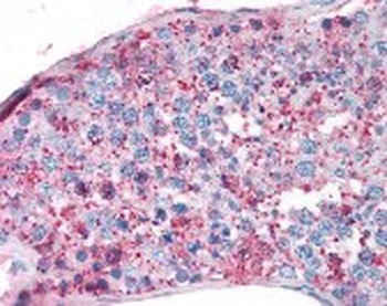 NR5A1 Antibody