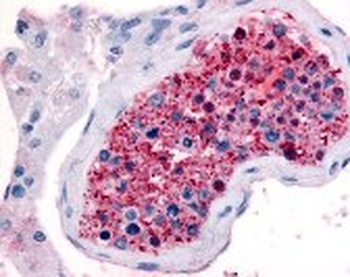 FZD9 Antibody