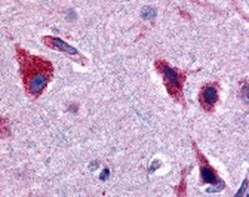 CERK Antibody
