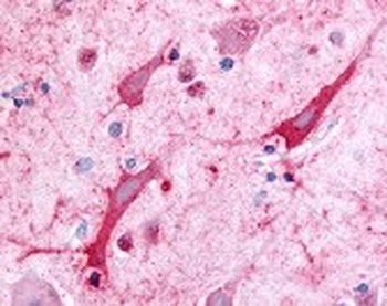CERK Antibody