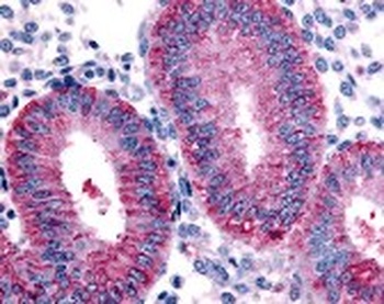 DKK1 Antibody