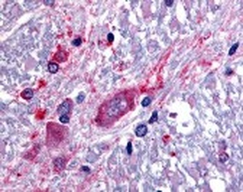 SLC5A3 Antibody
