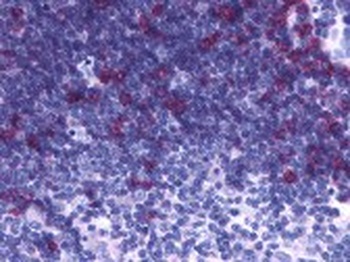 PTGDR2 Antibody