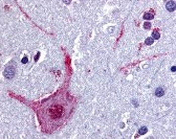 CHRM3 Antibody