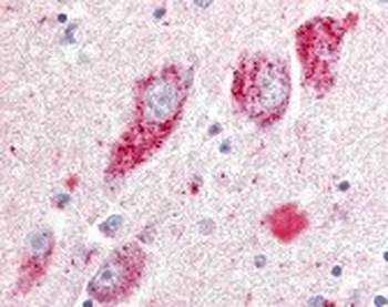 GPR20 Antibody