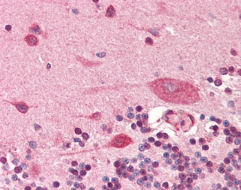 PDPN Antibody
