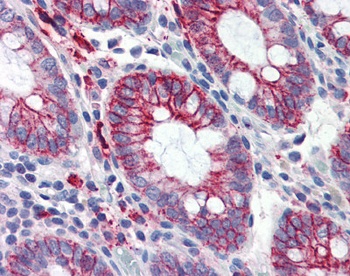 ITGB1 Antibody