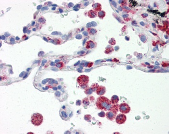 IRF7 Antibody