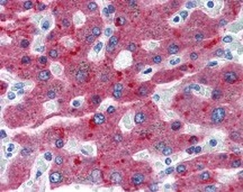 CFH Antibody