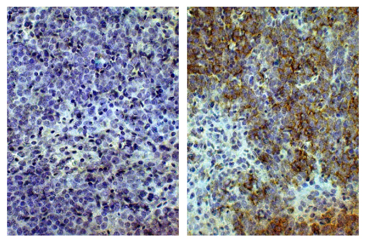 CD8A Antibody