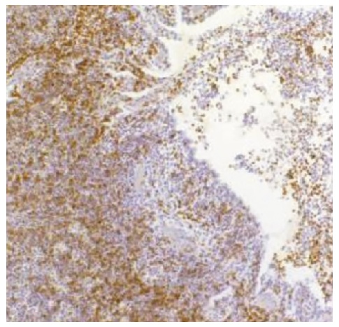 CD8A Antibody