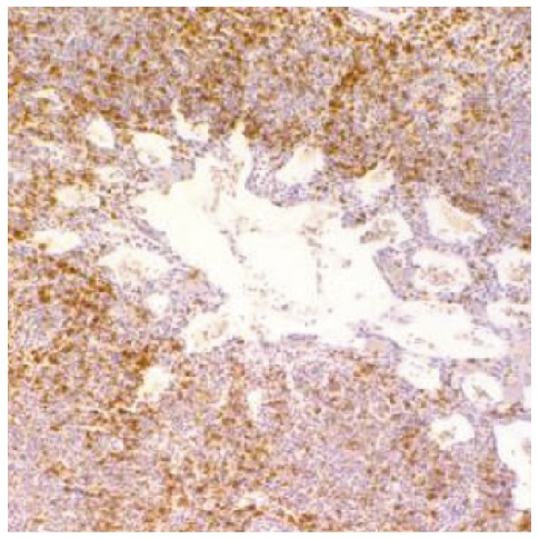 CD8A Antibody