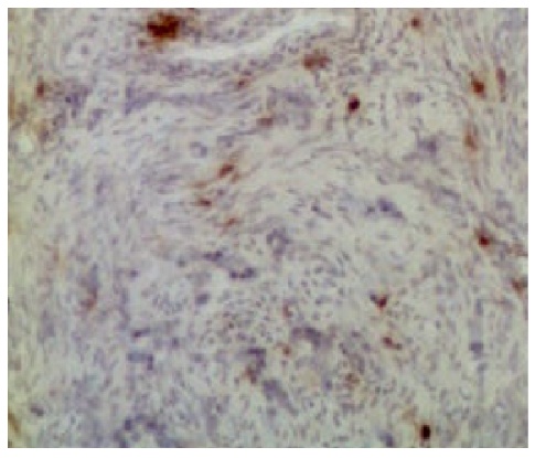 CD8A Antibody