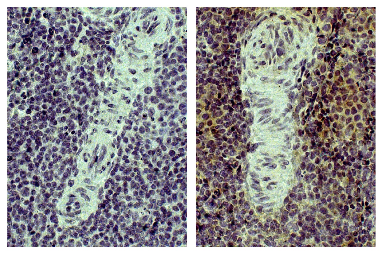 CD4 Antibody