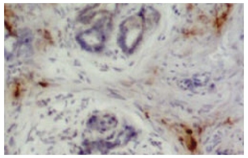 CD4 Antibody