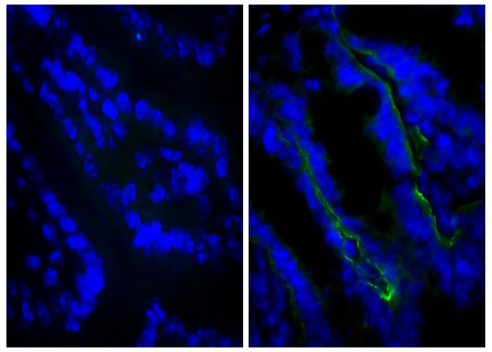 Itgb4 Antibody