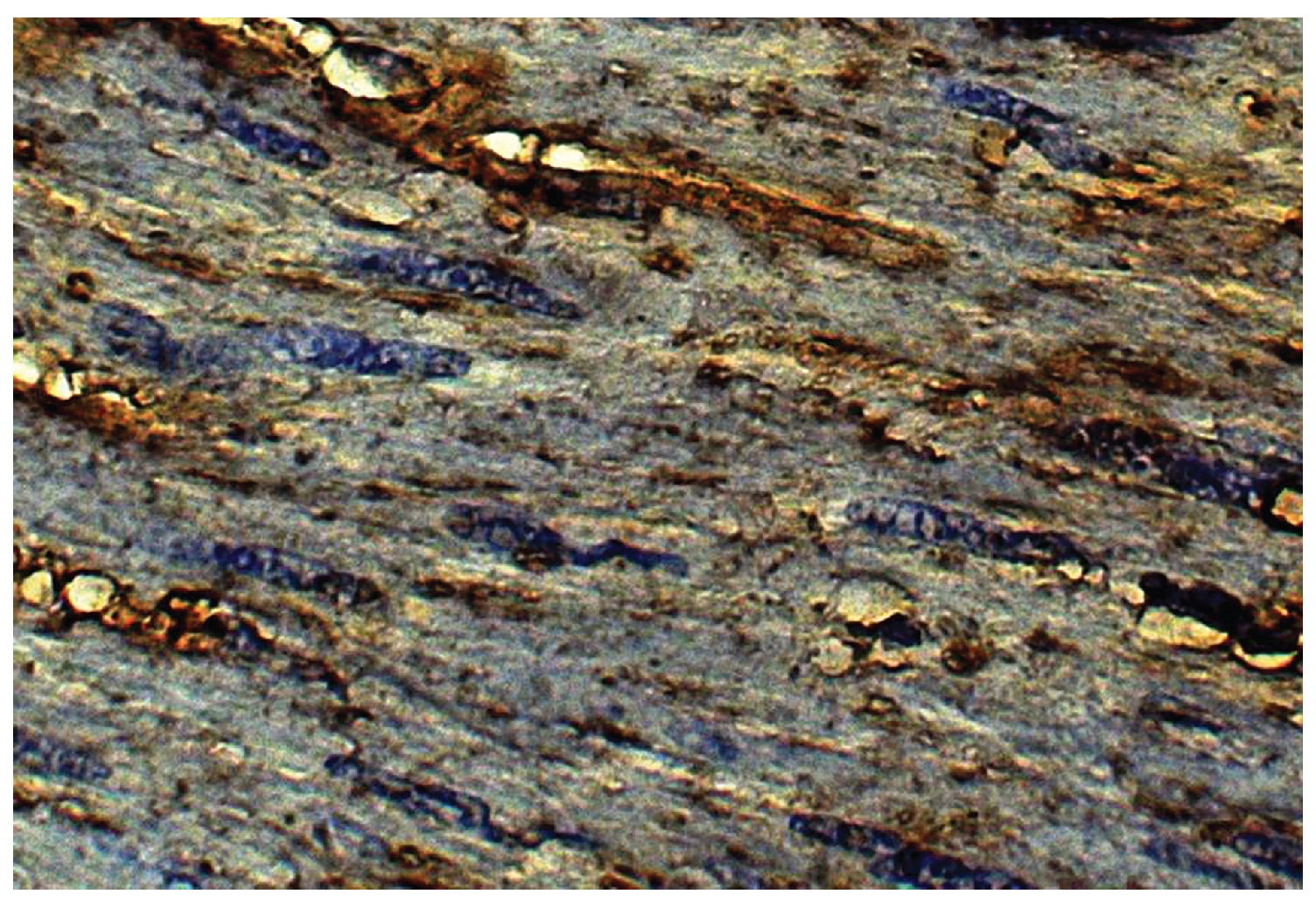 Type VI Collagen Antibody