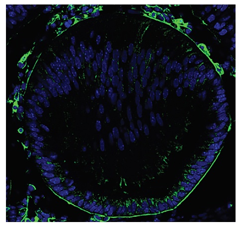 Type IV Collagen Antibody