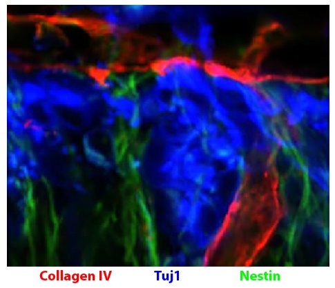 Type IV Collagen Antibody