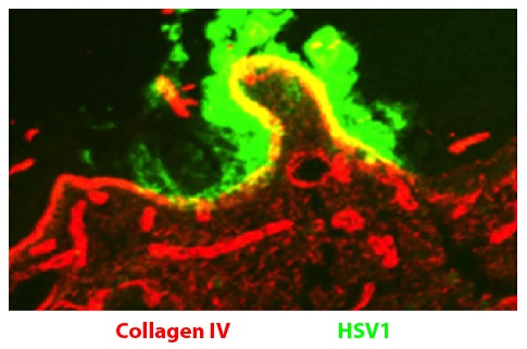 Type IV Collagen Antibody