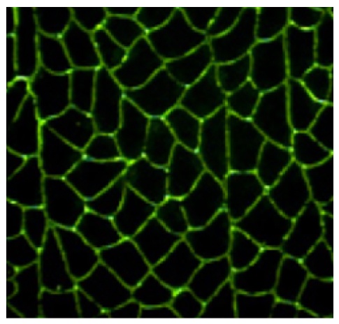 Type IV Collagen Antibody