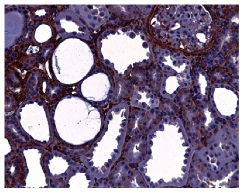 Type IV Collagen Antibody