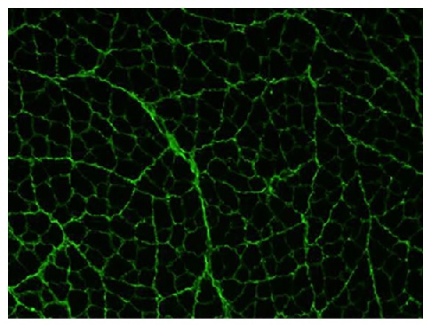 Type III Collagen Antibody