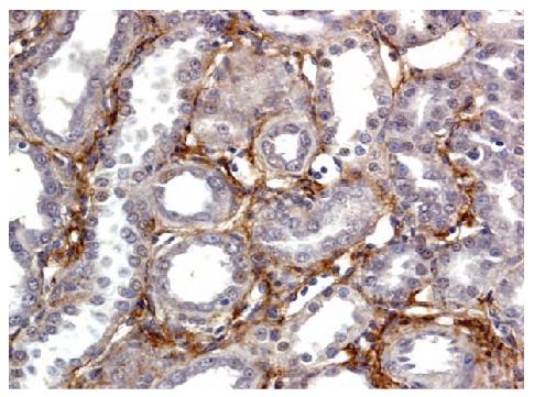 Type III Collagen Antibody