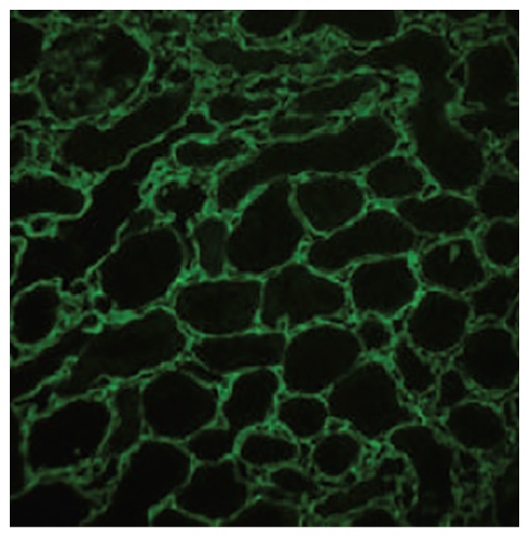 Type III Collagen Antibody