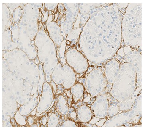 Type III Collagen Antibody