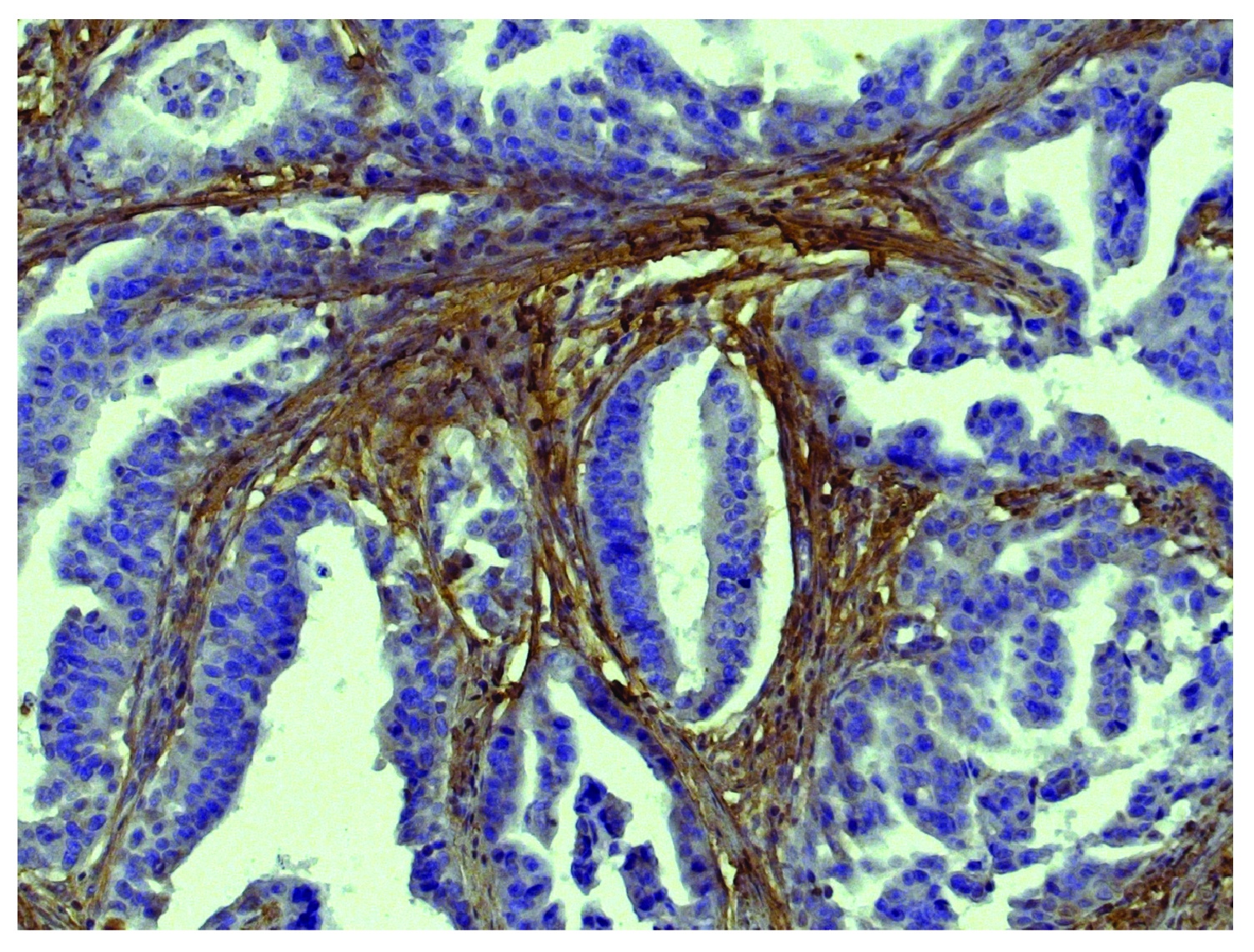 Type I Collagen Antibody (Biotin)