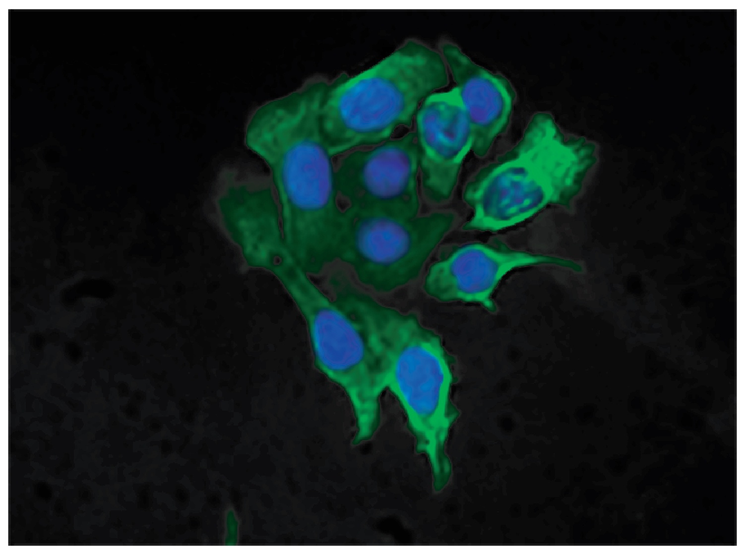 KRT8 Antibody (FITC)