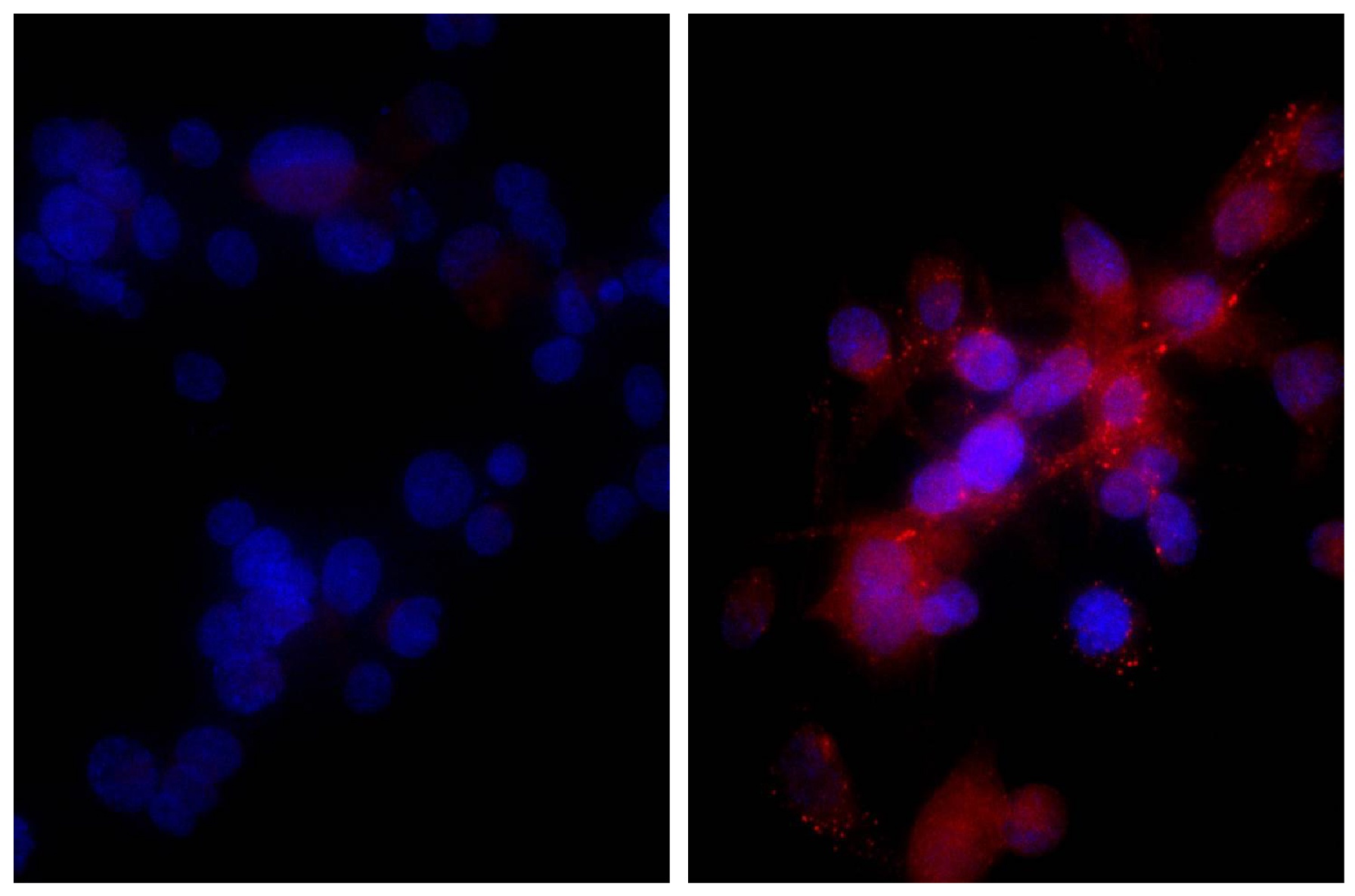 DR5 Antibody