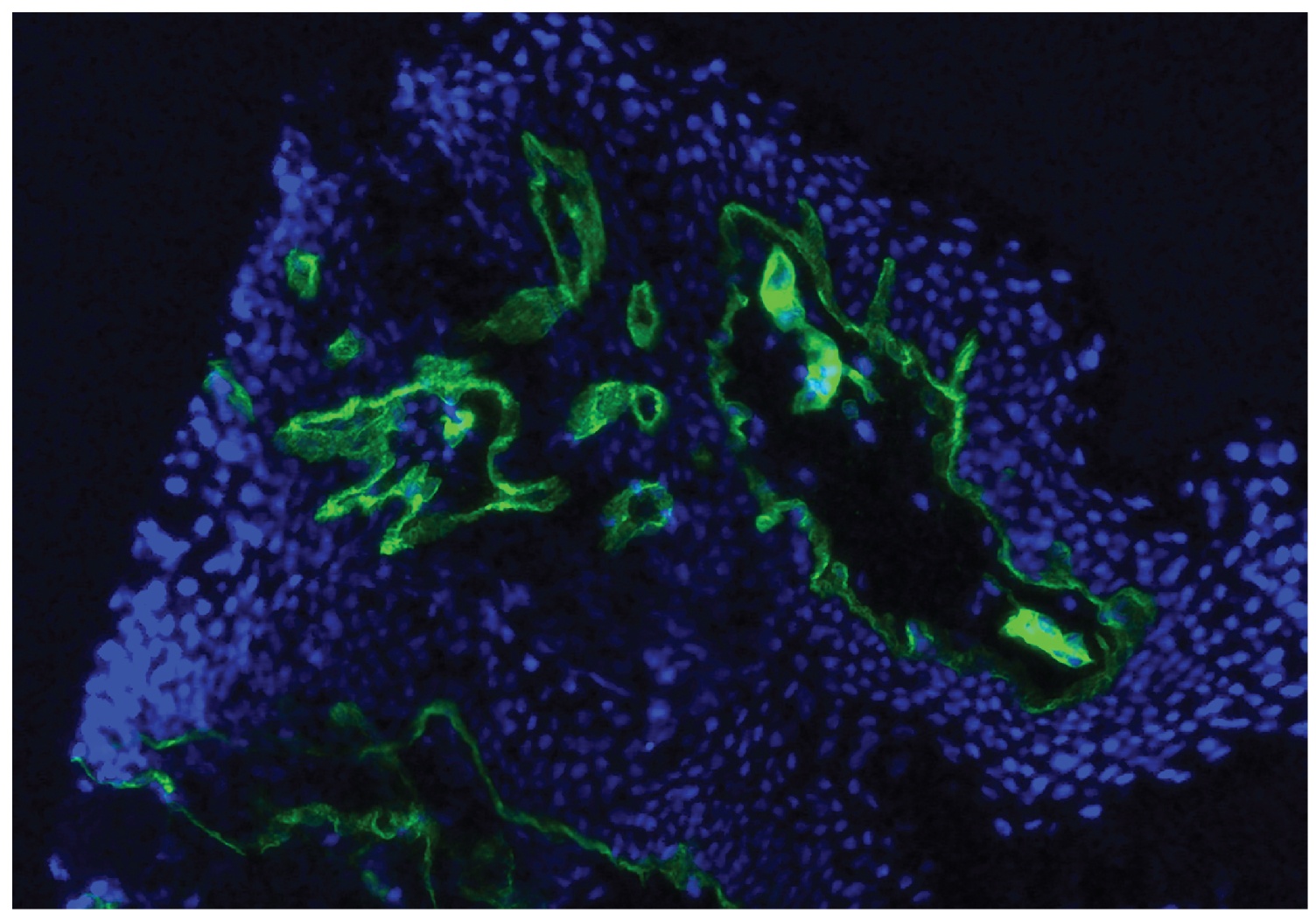 Type IV Collagen Antibody [2F11]