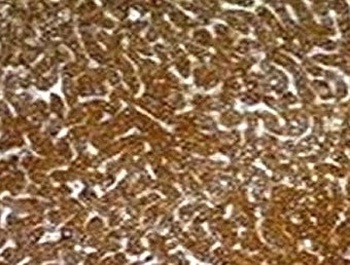 Hepatocyte Antibody [SPM582]