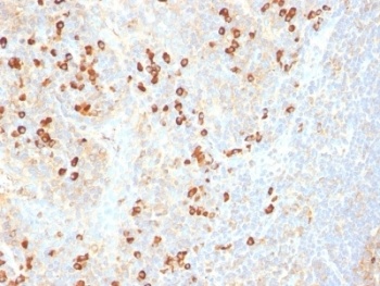 Plasma Cell Marker Antibody [SPM310]