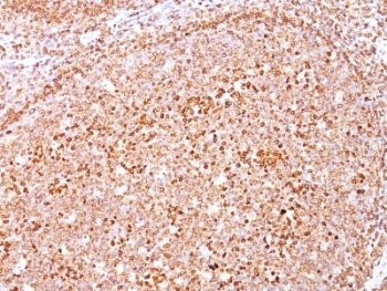 CD79A Antibody