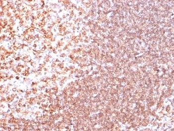 CD74 Antibody [SPM523]