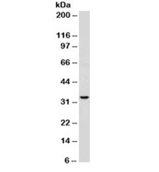 CD74 Antibody [SPM523]