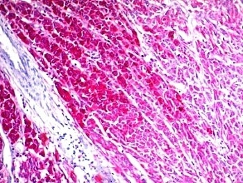 CD63 Antibody