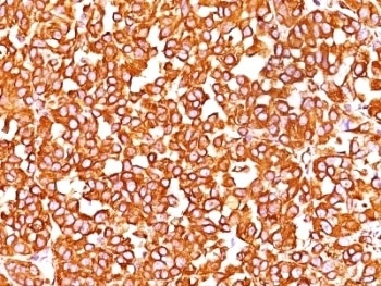 VIM Antibody