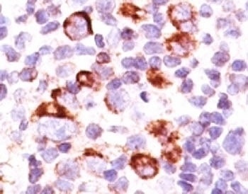 Bcl-X Antibody [SPM165]