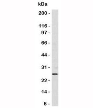Bcl-2 Antibody [SPM530]