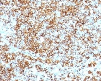 PTPRC Antibody
