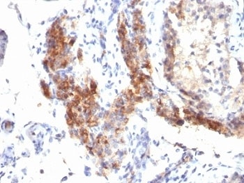FOXP3 Antibody