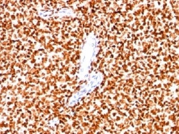 NKX2-2 Antibody