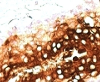 KRT17 Antibody