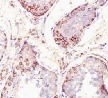 MAGEA1 Antibody