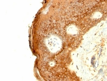 IVL Antibody